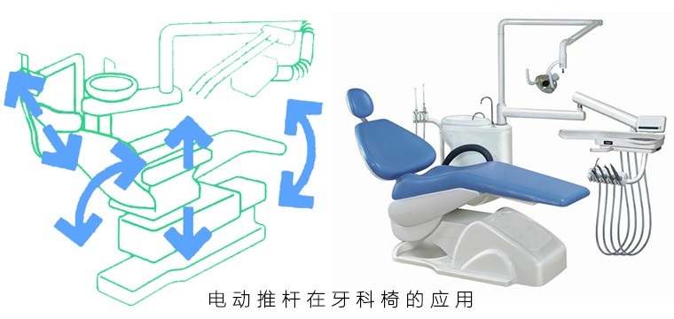 电动推杆在牙科椅上的应用